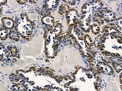 PLK5 Polyclonal Antibody, Invitrogen 100 &mu;L; Unconjugated:Antibodies,