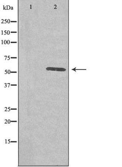 PLK5 Polyclonal Antibody, Invitrogen 100 &mu;L; Unconjugated:Antibodies,