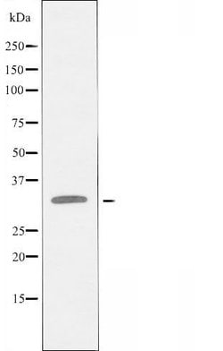 Invitrogen PRKY Polyclonal Antibody 100 &mu;L; Unconjugated:Antibodies,