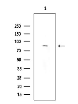 Invitrogen TLK2 Polyclonal Antibody 100 &mu;L; Unconjugated:Antibodies,