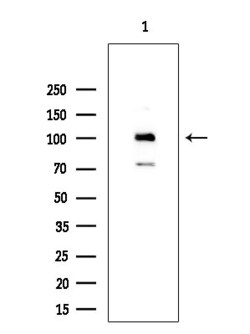 Invitrogen TLK2 Polyclonal Antibody 100 &mu;L; Unconjugated:Antibodies,