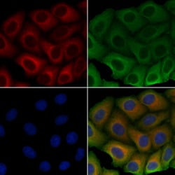 Invitrogen ULK3 Polyclonal Antibody 100 &mu;L; Unconjugated:Antibodies,