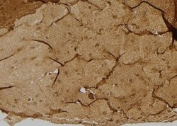 Invitrogen ULK3 Polyclonal Antibody 100 &mu;L; Unconjugated:Antibodies,