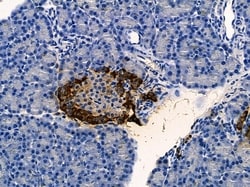 Invitrogen VRK2 Polyclonal Antibody 100 &mu;L; Unconjugated:Antibodies,
