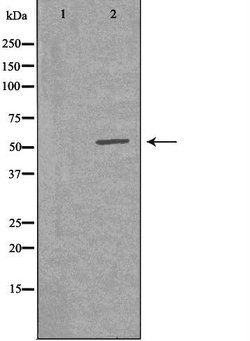 Invitrogen VRK2 Polyclonal Antibody 100 &mu;L; Unconjugated:Antibodies,