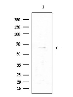 Invitrogen VRK2 Polyclonal Antibody 100 &mu;L; Unconjugated:Antibodies,