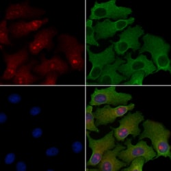 Invitrogen PPP2R3B Polyclonal Antibody 100 &mu;L; Unconjugated:Antibodies,