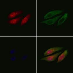 Invitrogen PPP2R3C Polyclonal Antibody 100 &mu;L; Unconjugated:Antibodies,