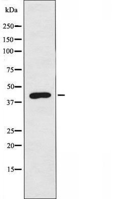 Invitrogen SERPINB12 Polyclonal Antibody 100 &mu;L; Unconjugated:Antibodies,