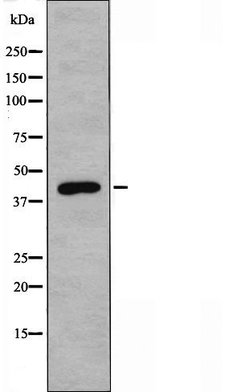Invitrogen SERPINB4 Polyclonal Antibody 100 &mu;L | Buy Online | Invitrogen&trade; | Fisher Scientific