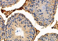 Invitrogen STAC2 Polyclonal Antibody 100 &mu;L; Unconjugated:Antibodies,