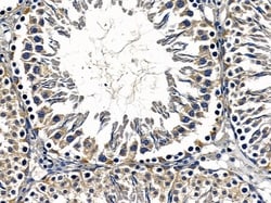 Invitrogen SHANK2 Polyclonal Antibody 100 &mu;L; Unconjugated:Antibodies,