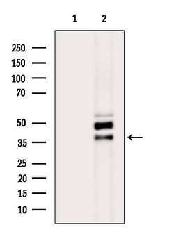 SH3GL2 Polyclonal Antibody:Antibodies, Polyclonal