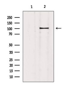 Invitrogen SLC4A11 Polyclonal Antibody 100 &mu;L; Unconjugated:Antibodies,