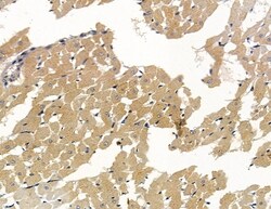 Invitrogen SCN4B Polyclonal Antibody 100 &mu;L | Buy Online | Invitrogen&trade; | Fisher Scientific
