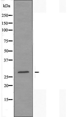 Invitrogen SCN4B Polyclonal Antibody 100 &mu;L | Buy Online | Invitrogen&trade; | Fisher Scientific