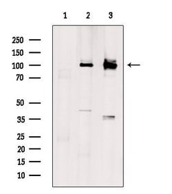 Invitrogen SLC9A6 Polyclonal Antibody 100 &mu;L | Buy Online | Invitrogen&trade; | Fisher Scientific