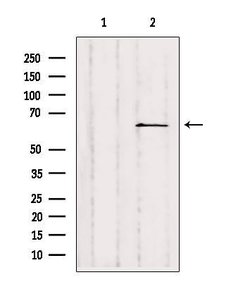 Invitrogen SLC28A2 Polyclonal Antibody 100 &mu;L; Unconjugated:Antibodies,