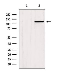 Invitrogen SLC24A1 Polyclonal Antibody 100 &mu;L; Unconjugated:Antibodies,
