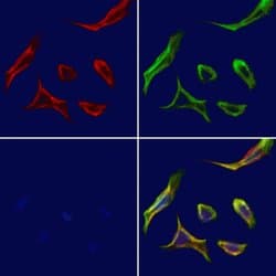 Invitrogen SLC24A4 Polyclonal Antibody 100 &mu;L; Unconjugated:Antibodies,