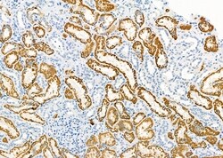 Invitrogen SLC5A6 Polyclonal Antibody 100 &mu;L; Unconjugated:Antibodies,