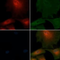 Invitrogen SLC4A8 Polyclonal Antibody 100 &mu;L; Unconjugated:Antibodies,