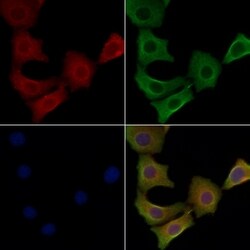 Invitrogen STMN4 Polyclonal Antibody 100 &mu;L; Unconjugated:Antibodies,