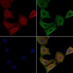Invitrogen STMN4 Polyclonal Antibody 100 &mu;L; Unconjugated:Antibodies,