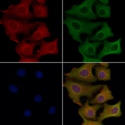 SVOP Polyclonal Antibody, Invitrogen 100 &mu;L; Unconjugated:Antibodies,