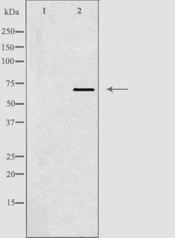Invitrogen TBX18 Polyclonal Antibody 100 &mu;L; Unconjugated:Antibodies,