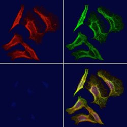 Invitrogen CD1E Polyclonal Antibody 100 &mu;L; Unconjugated:Antibodies,