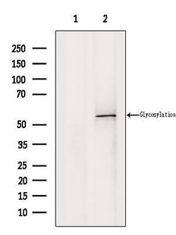 Invitrogen CD1E Polyclonal Antibody 100 &mu;L; Unconjugated:Antibodies,