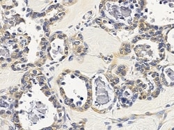 Invitrogen TSSK4 Polyclonal Antibody 100 &mu;L; Unconjugated:Antibodies,