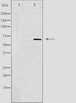 Invitrogen TIGD1 Polyclonal Antibody 100 &mu;L | Buy Online | Invitrogen&trade; | Fisher Scientific