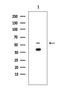 Invitrogen TIGD3 Polyclonal Antibody 100 &mu;L; Unconjugated:Antibodies,