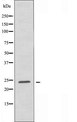 Invitrogen TCEAL6 Polyclonal Antibody 100 &mu;L; Unconjugated:Antibodies,