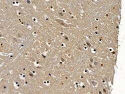 Invitrogen TAF3 Polyclonal Antibody 100 &mu;L; Unconjugated:Antibodies,