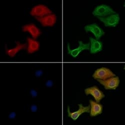 Invitrogen MTERF Polyclonal Antibody 100 &mu;L | Buy Online | Invitrogen&trade; | Fisher Scientific