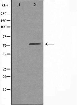 Invitrogen EIF2B4 Polyclonal Antibody 100 &mu;L; Unconjugated:Antibodies,