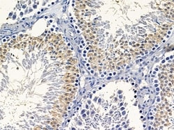 Invitrogen PEAK1 Polyclonal Antibody 100 &mu;L; Unconjugated:Antibodies,