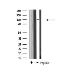 Invitrogen USP11 Polyclonal Antibody 100 &mu;L; Unconjugated:Antibodies,