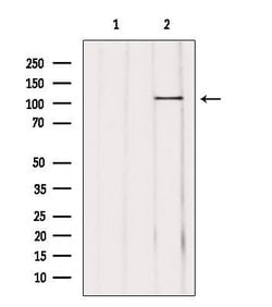 Invitrogen USP11 Polyclonal Antibody 100 &mu;L; Unconjugated:Antibodies,
