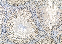 Invitrogen USP19 Polyclonal Antibody 100 &mu;L | Buy Online | Invitrogen&trade; | Fisher Scientific