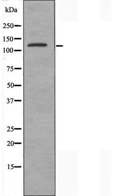 Invitrogen USP19 Polyclonal Antibody 100 &mu;L | Buy Online | Invitrogen&trade; | Fisher Scientific