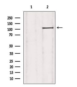 Invitrogen USP38 Polyclonal Antibody 100 &mu;L; Unconjugated:Antibodies,