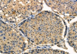 Invitrogen USP45 Polyclonal Antibody 100 &mu;L; Unconjugated:Antibodies,