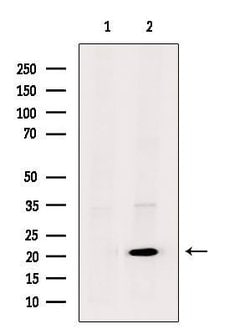 Invitrogen UBE2T Polyclonal Antibody 100 &mu;L; Unconjugated:Antibodies,