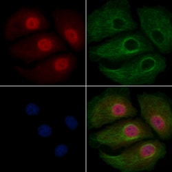 Invitrogen UGDH Polyclonal Antibody 100 &mu;L | Buy Online | Invitrogen&trade; | Fisher Scientific