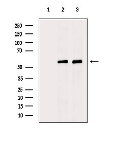 Invitrogen UGDH Polyclonal Antibody 100 &mu;L | Buy Online | Invitrogen&trade; | Fisher Scientific