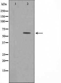 Invitrogen ATP6V1B1 Polyclonal Antibody 100 &mu;L; Unconjugated:Antibodies,